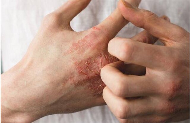 آینده پروبیوتیک‌ها