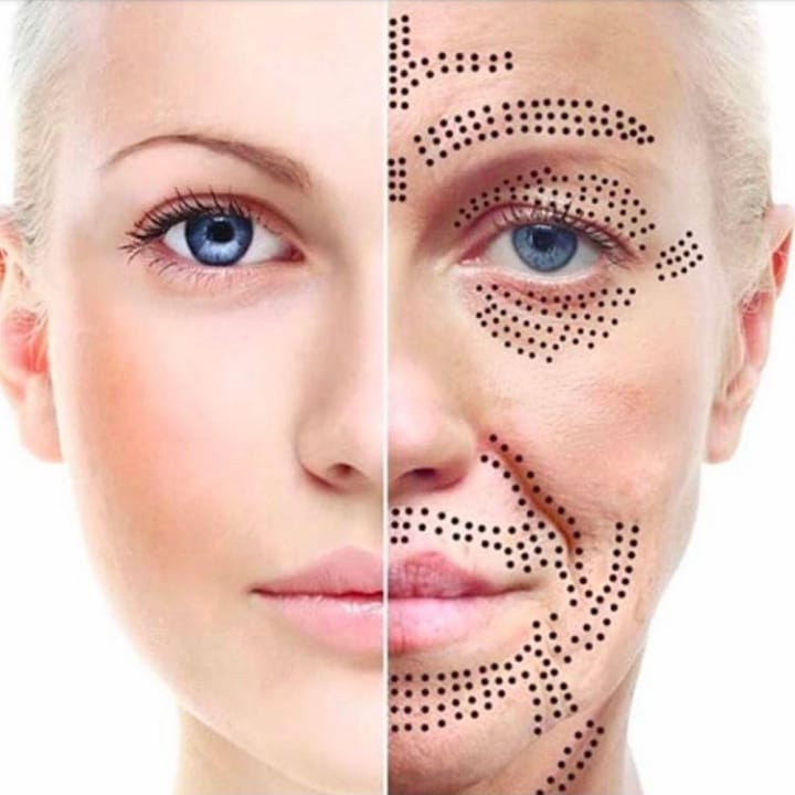 پلاسما تراپی